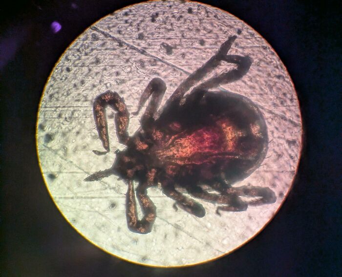 72 Unbelievable Microscope Images That Look Like They’re From Another Planet 72 Unbelievable Microscope Images That Look Like They’re From Another Planet