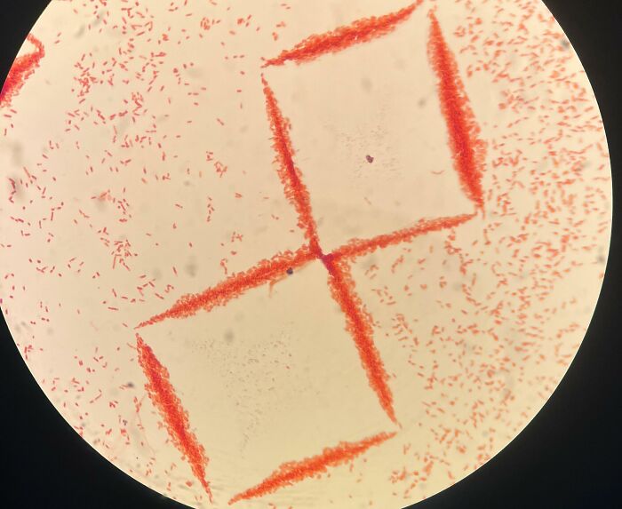 72 Unbelievable Microscope Images That Look Like They’re From Another Planet 72 Unbelievable Microscope Images That Look Like They’re From Another Planet