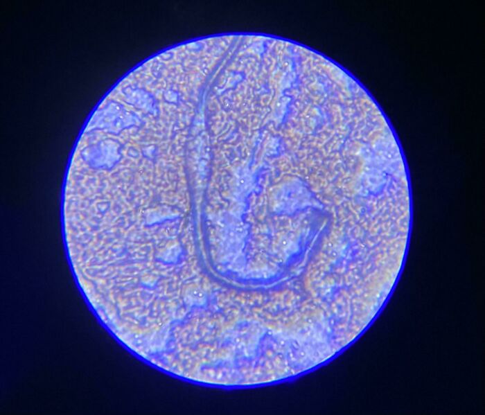 72 Unbelievable Microscope Images That Look Like They’re From Another Planet 72 Unbelievable Microscope Images That Look Like They’re From Another Planet