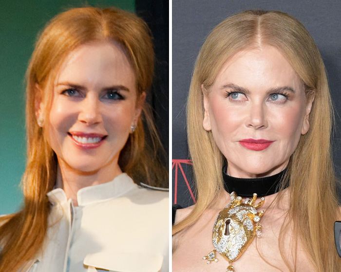 All The Signs Pointing To Your Coworker&rsquo;s Secret Plastic Surgery, From Bat Ears To Bunny Nose And A Hairstyle Change