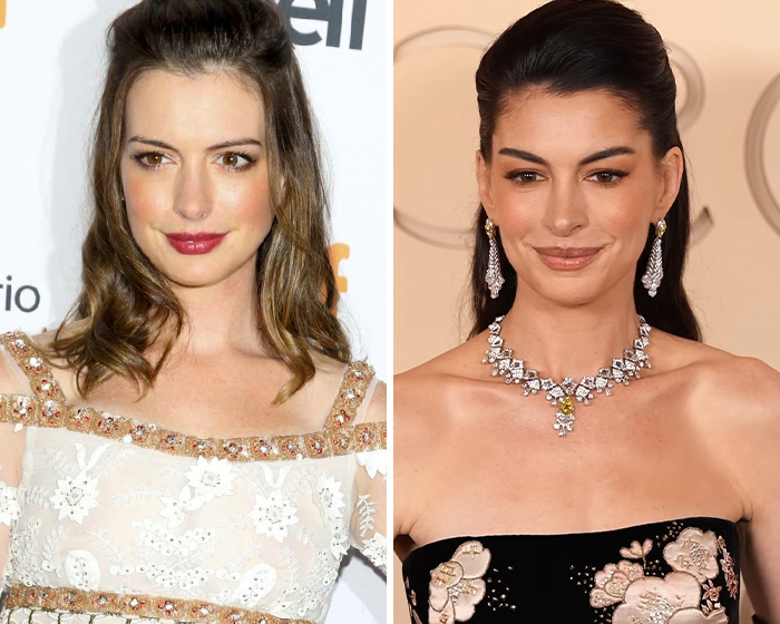 All The Signs Pointing To Your Coworker&rsquo;s Secret Plastic Surgery, From Bat Ears To Bunny Nose And A Hairstyle Change