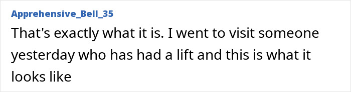 All The Signs Pointing To Your Coworker&rsquo;s Secret Plastic Surgery, From Bat Ears To Bunny Nose And A Hairstyle Change