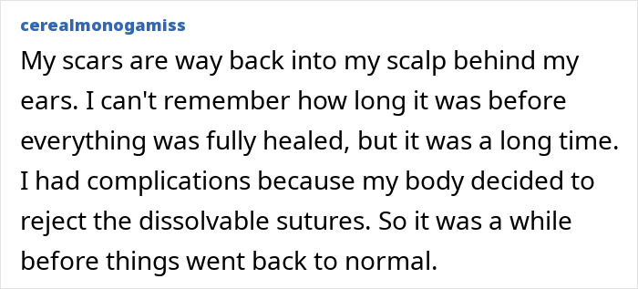 All The Signs Pointing To Your Coworker&rsquo;s Secret Plastic Surgery, From Bat Ears To Bunny Nose And A Hairstyle Change