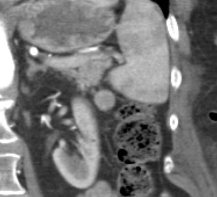 69 Fascinating And Unsettling Facts That Might Make People Wonder Why In The World Anyone  Would Know Them