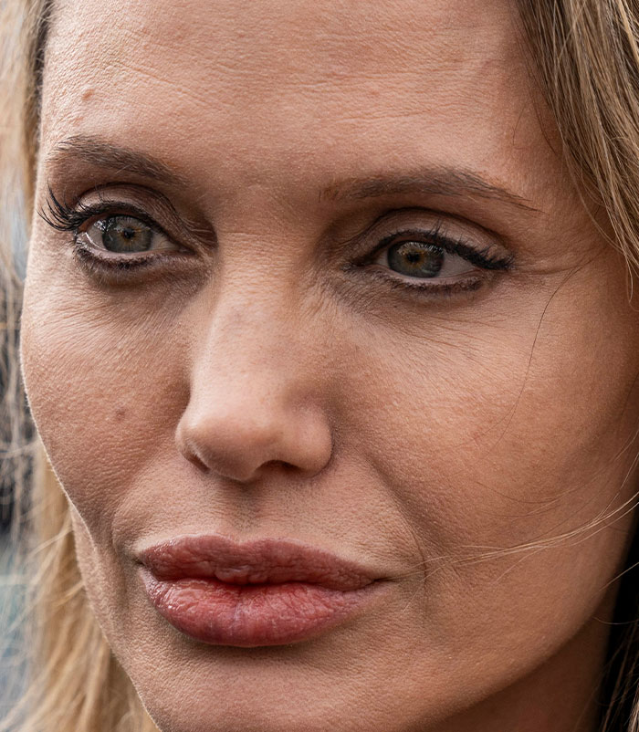 50+ Photos Of Celebrities&rsquo; Skins Up Close That Show They&rsquo;re Human Just Like Us