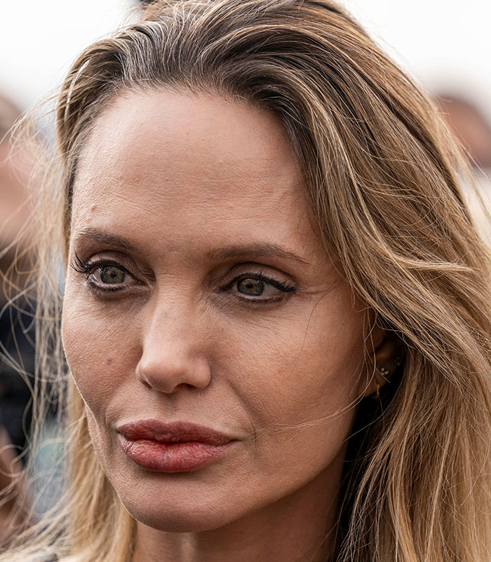 50+ Photos Of Celebrities&rsquo; Skins Up Close That Show They&rsquo;re Human Just Like Us