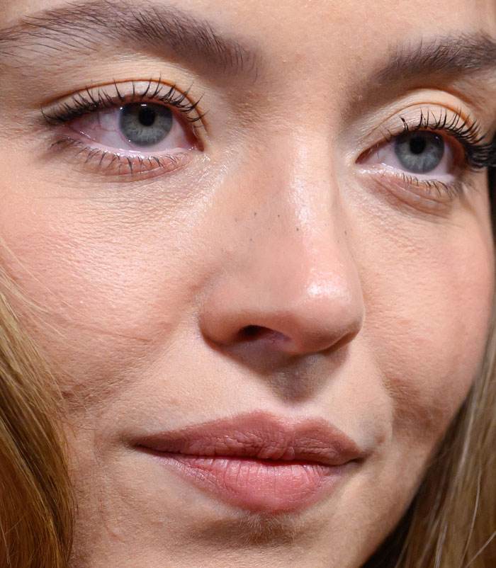 50+ Photos Of Celebrities&rsquo; Skins Up Close That Show They&rsquo;re Human Just Like Us