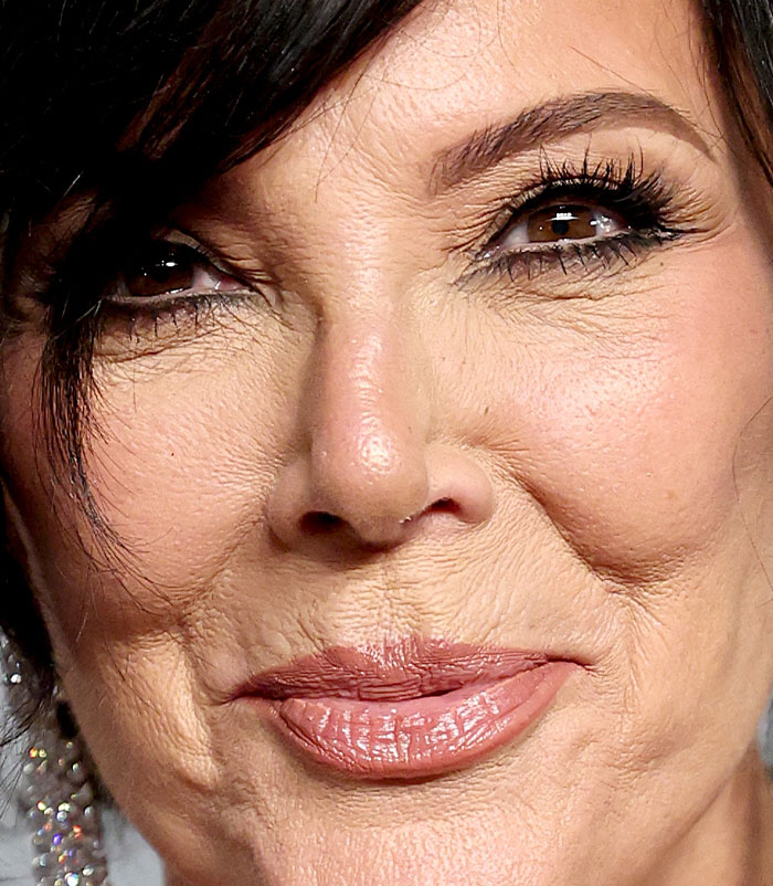 50+ Photos Of Celebrities&rsquo; Skins Up Close That Show They&rsquo;re Human Just Like Us