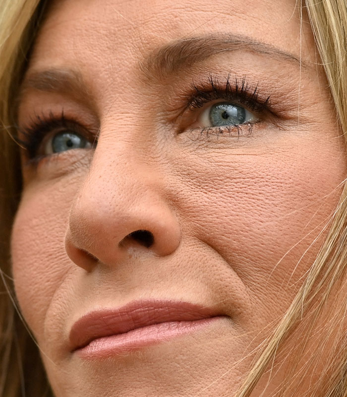 50+ Photos Of Celebrities&rsquo; Skins Up Close That Show They&rsquo;re Human Just Like Us