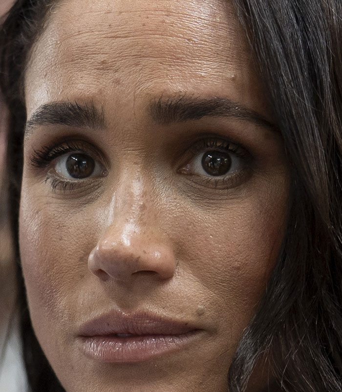 50+ Photos Of Celebrities&rsquo; Skins Up Close That Show They&rsquo;re Human Just Like Us