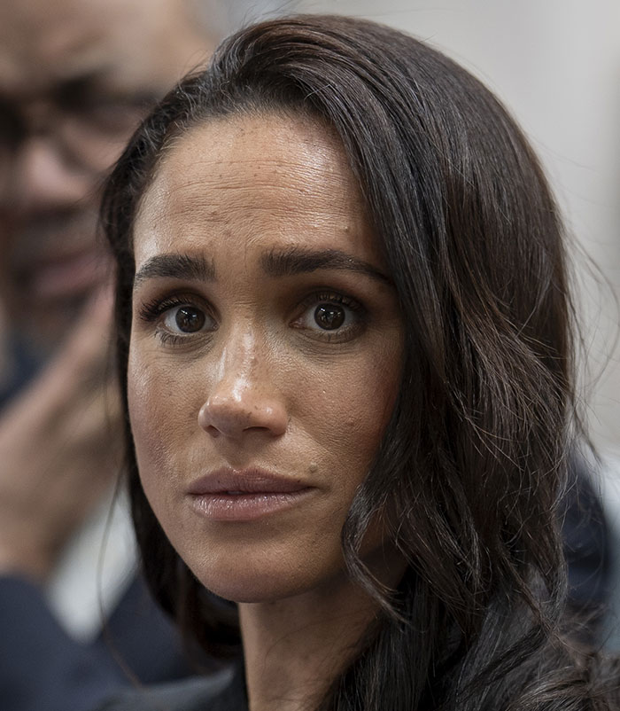 50+ Photos Of Celebrities&rsquo; Skins Up Close That Show They&rsquo;re Human Just Like Us