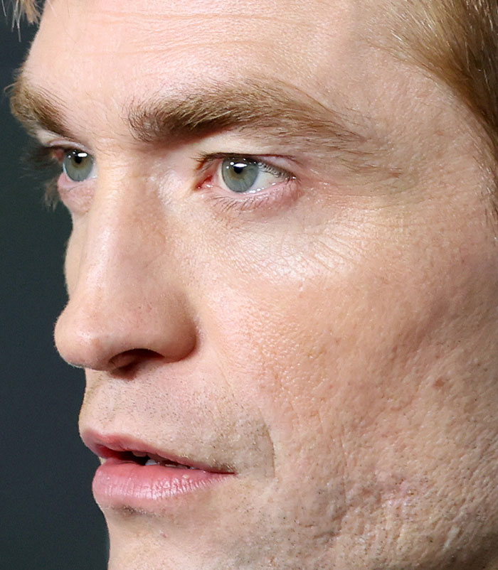50+ Photos Of Celebrities&rsquo; Skins Up Close That Show They&rsquo;re Human Just Like Us