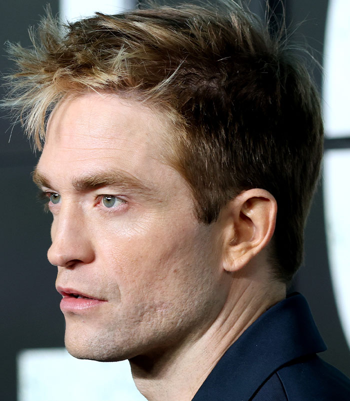 50+ Photos Of Celebrities&rsquo; Skins Up Close That Show They&rsquo;re Human Just Like Us