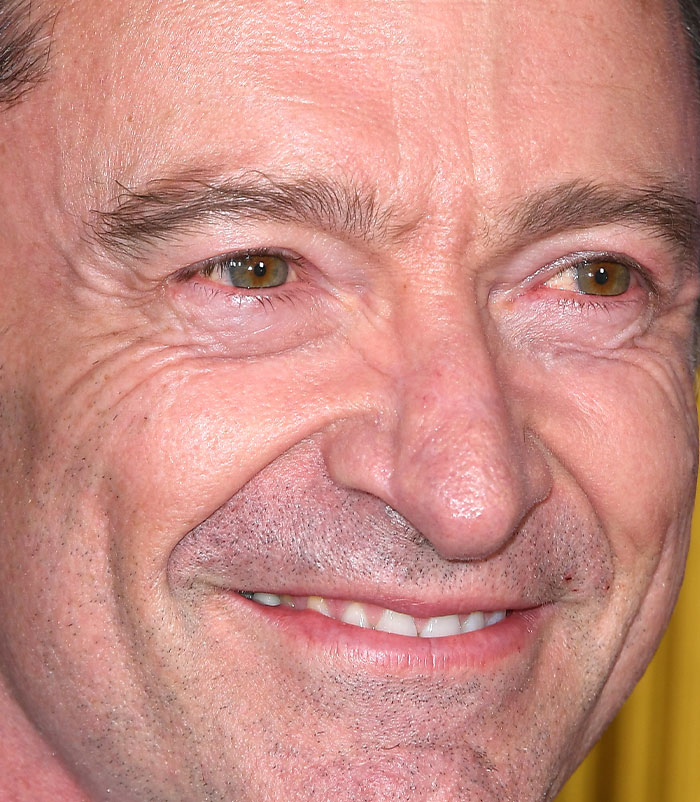 50+ Photos Of Celebrities&rsquo; Skins Up Close That Show They&rsquo;re Human Just Like Us