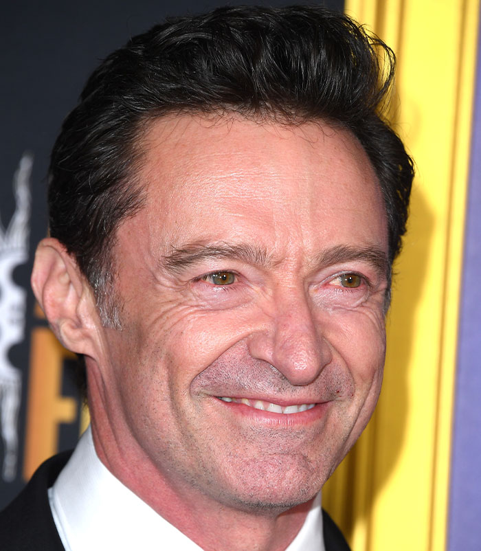 50+ Photos Of Celebrities&rsquo; Skins Up Close That Show They&rsquo;re Human Just Like Us