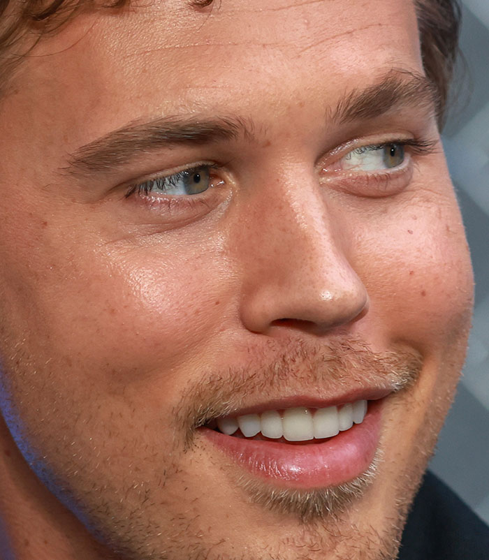 50+ Photos Of Celebrities&rsquo; Skins Up Close That Show They&rsquo;re Human Just Like Us