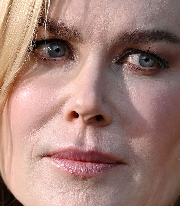 50+ Photos Of Celebrities&rsquo; Skins Up Close That Show They&rsquo;re Human Just Like Us