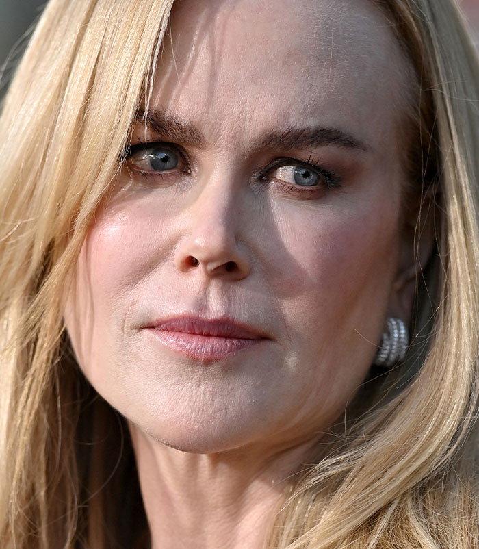 50+ Photos Of Celebrities&rsquo; Skins Up Close That Show They&rsquo;re Human Just Like Us