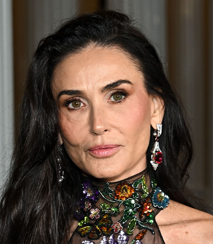 50+ Photos Of Celebrities&rsquo; Skins Up Close That Show They&rsquo;re Human Just Like Us