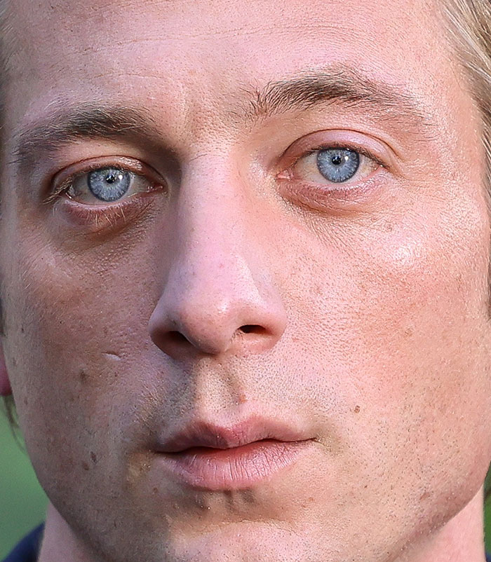 50+ Photos Of Celebrities&rsquo; Skins Up Close That Show They&rsquo;re Human Just Like Us