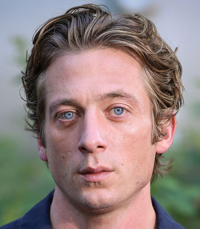 50+ Photos Of Celebrities&rsquo; Skins Up Close That Show They&rsquo;re Human Just Like Us