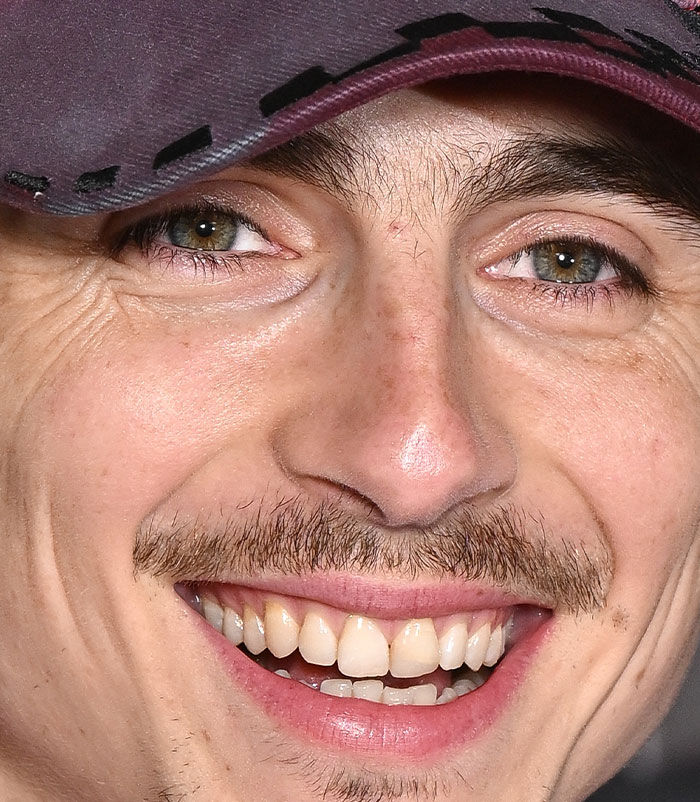 50+ Photos Of Celebrities&rsquo; Skins Up Close That Show They&rsquo;re Human Just Like Us