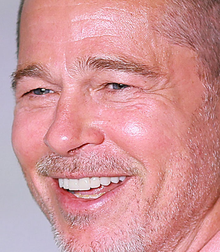 50+ Photos Of Celebrities&rsquo; Skins Up Close That Show They&rsquo;re Human Just Like Us