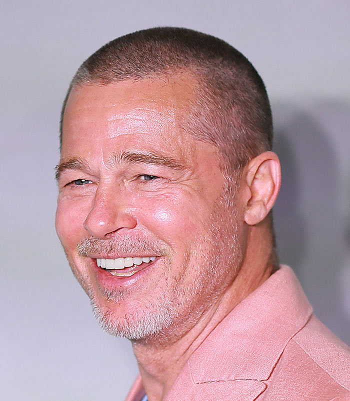 50+ Photos Of Celebrities&rsquo; Skins Up Close That Show They&rsquo;re Human Just Like Us