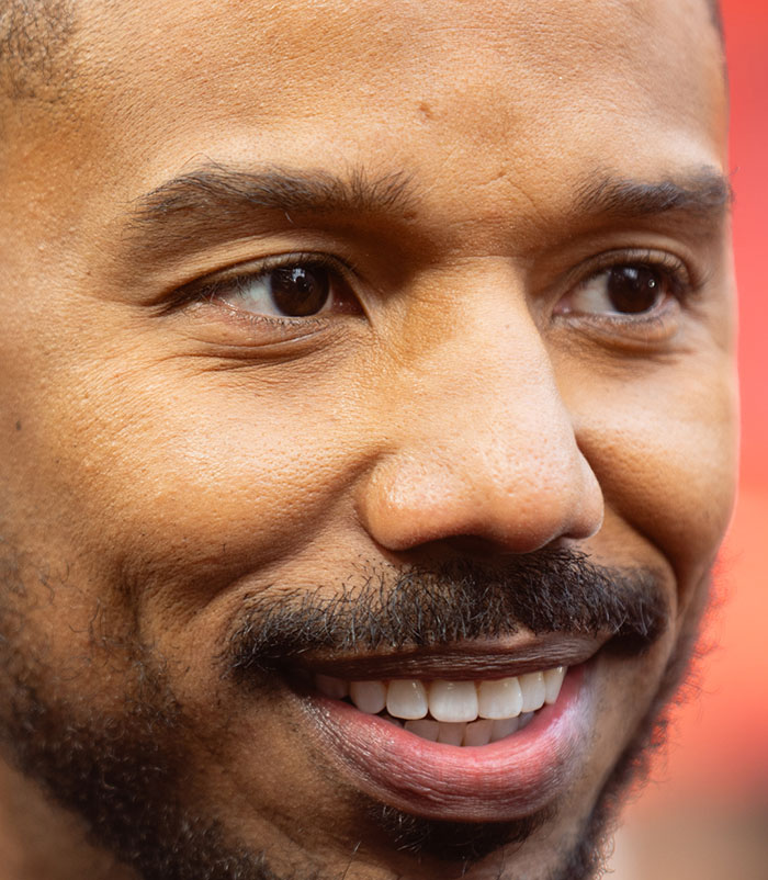 50+ Photos Of Celebrities&rsquo; Skins Up Close That Show They&rsquo;re Human Just Like Us