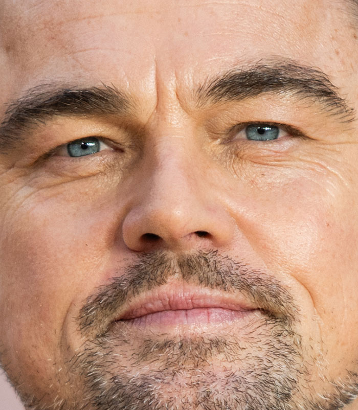 50+ Photos Of Celebrities&rsquo; Skins Up Close That Show They&rsquo;re Human Just Like Us