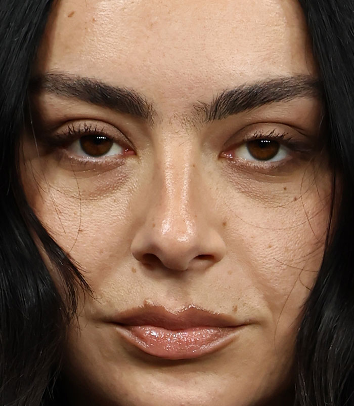 50+ Photos Of Celebrities&rsquo; Skins Up Close That Show They&rsquo;re Human Just Like Us