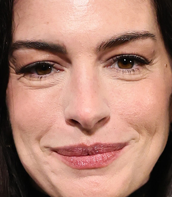 50+ Photos Of Celebrities&rsquo; Skins Up Close That Show They&rsquo;re Human Just Like Us