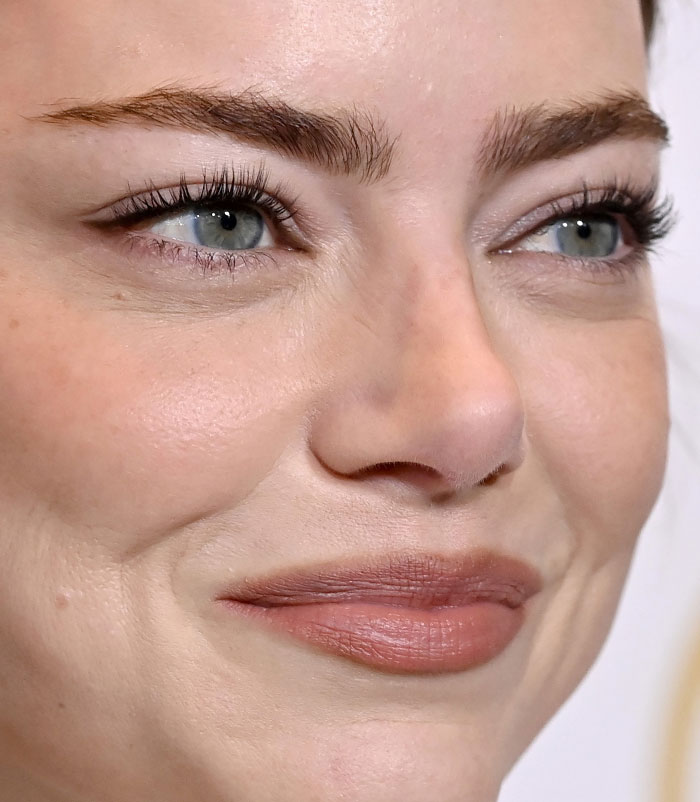 50+ Photos Of Celebrities&rsquo; Skins Up Close That Show They&rsquo;re Human Just Like Us
