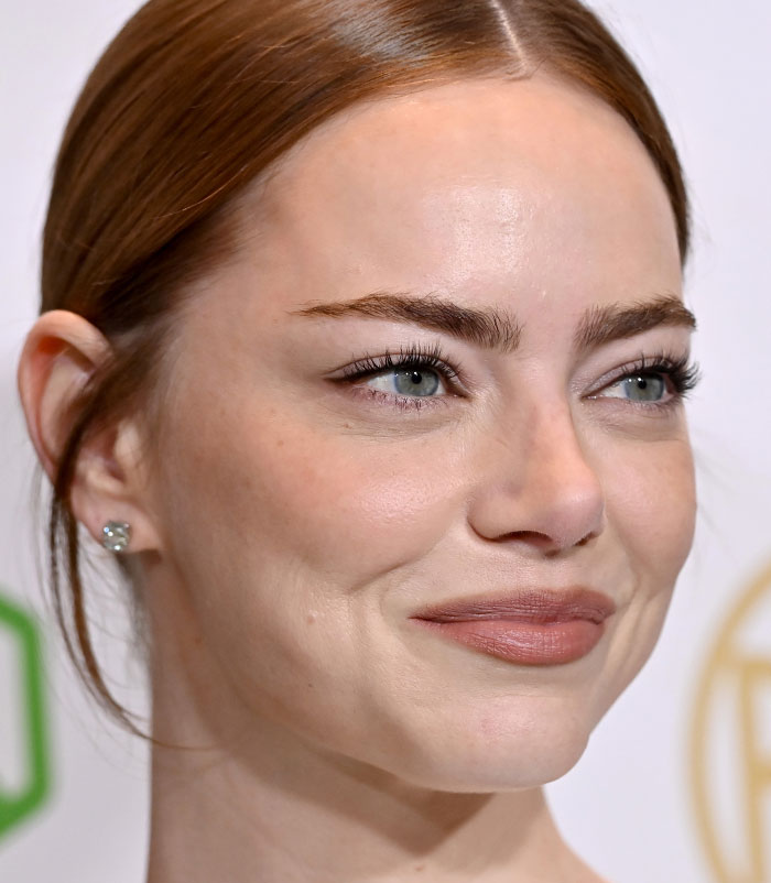 50+ Photos Of Celebrities&rsquo; Skins Up Close That Show They&rsquo;re Human Just Like Us