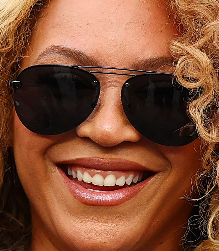 50+ Photos Of Celebrities&rsquo; Skins Up Close That Show They&rsquo;re Human Just Like Us