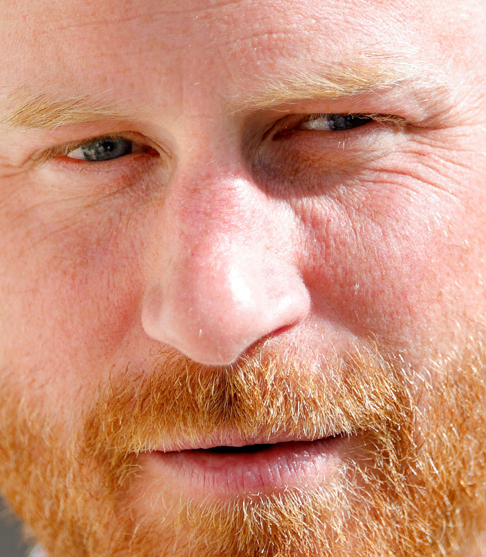 50+ Photos Of Celebrities&rsquo; Skins Up Close That Show They&rsquo;re Human Just Like Us