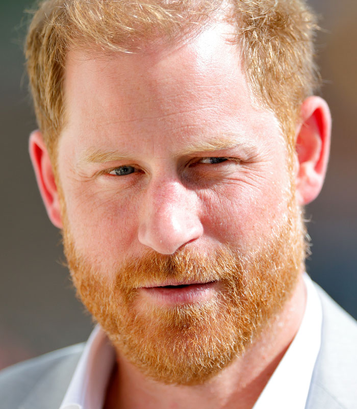 50+ Photos Of Celebrities&rsquo; Skins Up Close That Show They&rsquo;re Human Just Like Us