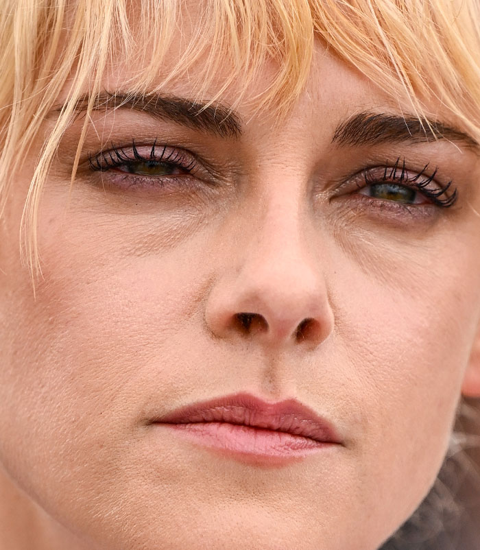 50+ Photos Of Celebrities&rsquo; Skins Up Close That Show They&rsquo;re Human Just Like Us
