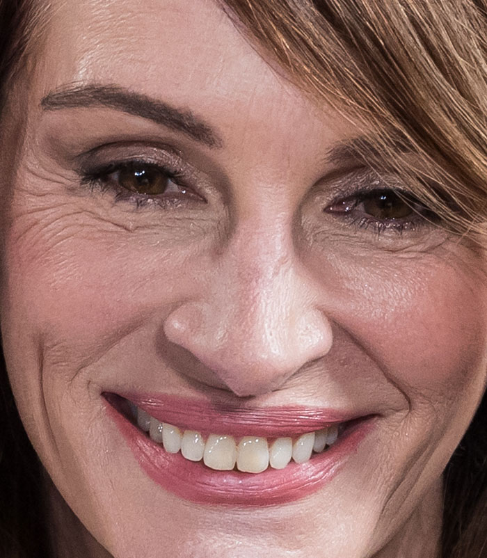 50+ Photos Of Celebrities&rsquo; Skins Up Close That Show They&rsquo;re Human Just Like Us