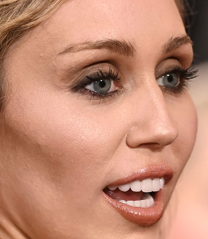 50+ Photos Of Celebrities&rsquo; Skins Up Close That Show They&rsquo;re Human Just Like Us