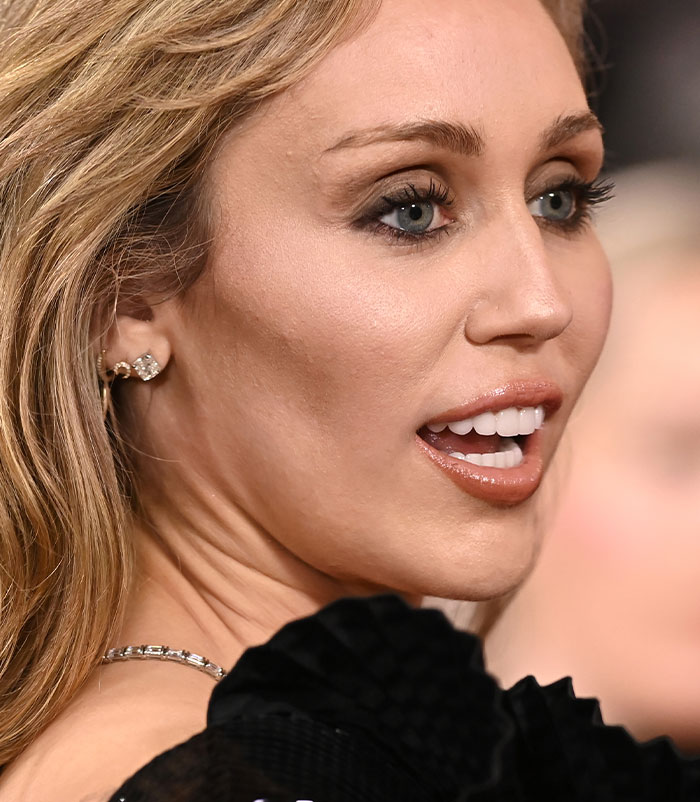 50+ Photos Of Celebrities&rsquo; Skins Up Close That Show They&rsquo;re Human Just Like Us