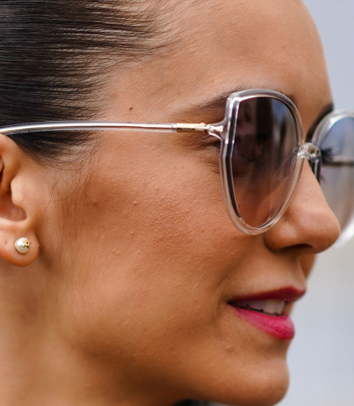 50+ Photos Of Celebrities&rsquo; Skins Up Close That Show They&rsquo;re Human Just Like Us