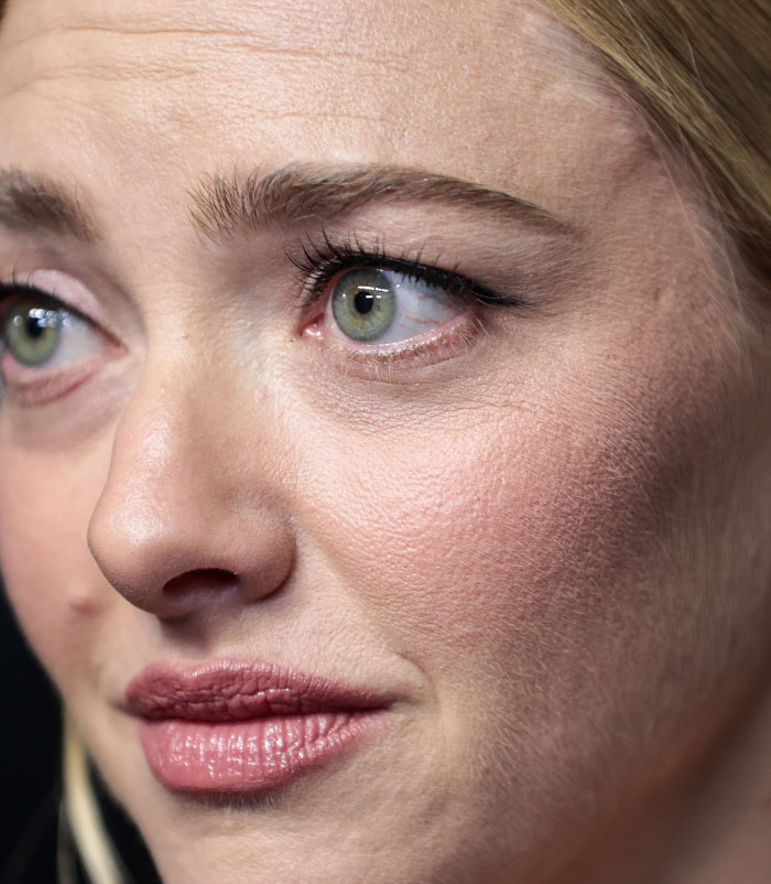 50+ Photos Of Celebrities&rsquo; Skins Up Close That Show They&rsquo;re Human Just Like Us