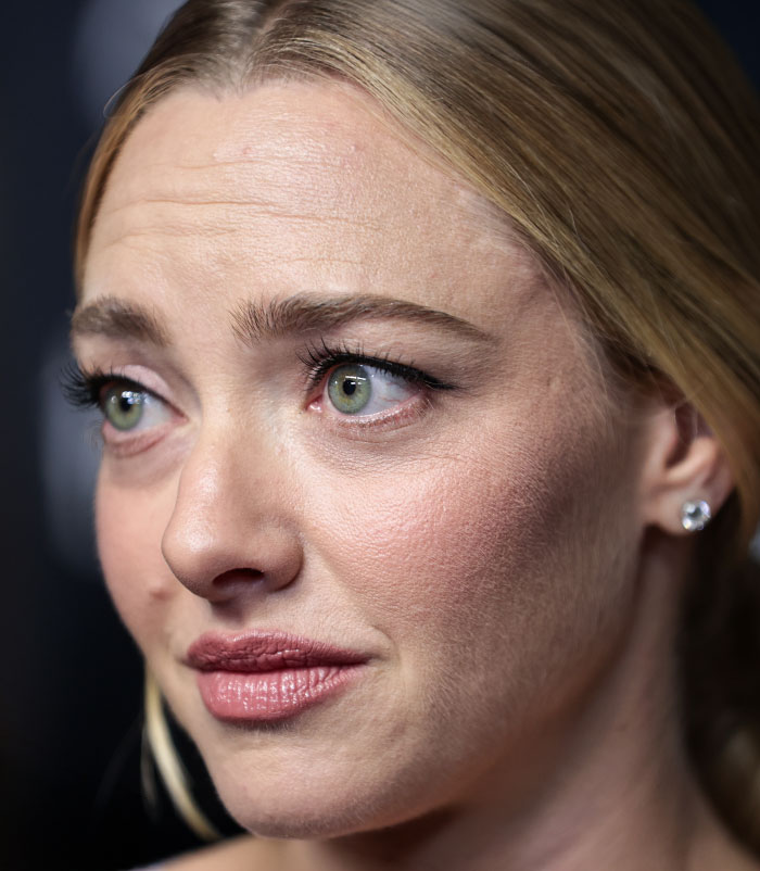 50+ Photos Of Celebrities&rsquo; Skins Up Close That Show They&rsquo;re Human Just Like Us