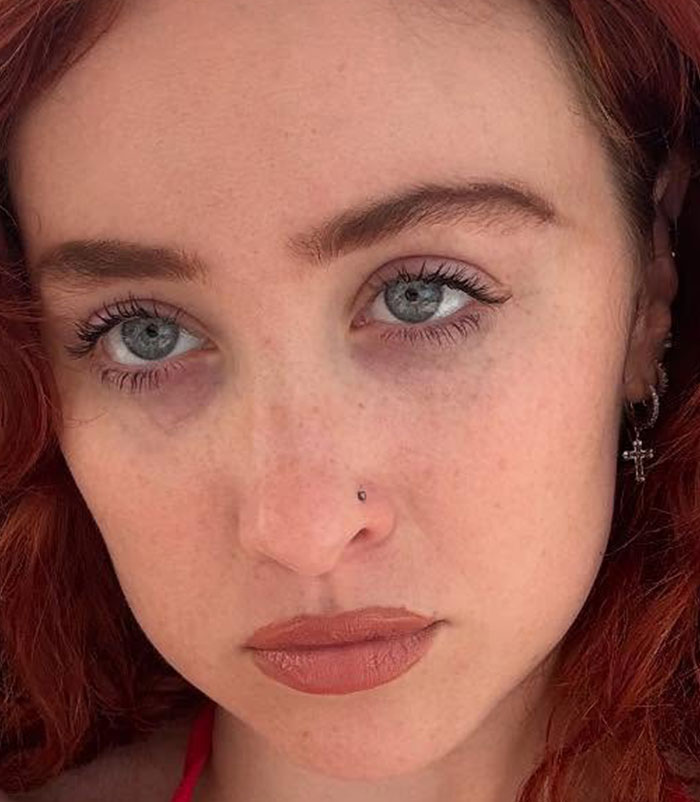 50+ Photos Of Celebrities&rsquo; Skins Up Close That Show They&rsquo;re Human Just Like Us