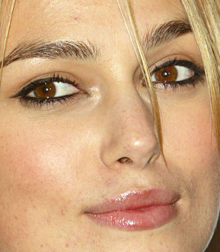 50+ Photos Of Celebrities&rsquo; Skins Up Close That Show They&rsquo;re Human Just Like Us