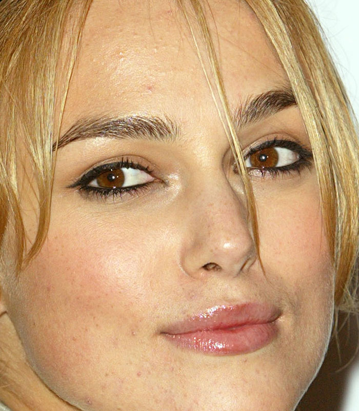 50+ Photos Of Celebrities&rsquo; Skins Up Close That Show They&rsquo;re Human Just Like Us