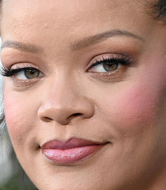 50+ Photos Of Celebrities&rsquo; Skins Up Close That Show They&rsquo;re Human Just Like Us