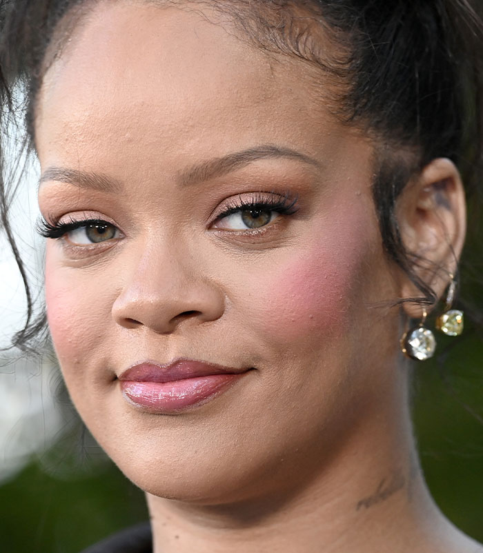 50+ Photos Of Celebrities&rsquo; Skins Up Close That Show They&rsquo;re Human Just Like Us