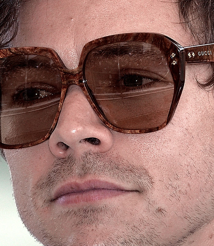 50+ Photos Of Celebrities&rsquo; Skins Up Close That Show They&rsquo;re Human Just Like Us